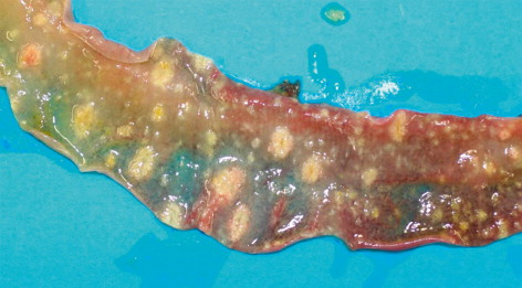 Figure 2b. Detail of intestinal ulceration.