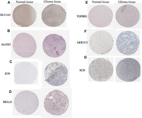 Figure 12 Expression validation of SLC1A5 (A), ALOX5 (B), JUN (C), HELLS (D), TGFBR1 (E), AKR1C3 (F) and SCD (G) in normal control tissue and glioma brain tissue groups at the protein level.