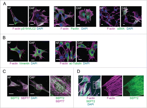 Figure 1. Cytoskeletal networks in normal mammary fibroblasts (NFs) and MMTV-PyMT derived breast CAFs (CAFs). (A) Left panels show images of F-actin (magenta), pS19-MLC2 (green) and DAPI (blue). Middle panels show F-actin (magenta), paxillin (green) and DAPI (blue) staining. Right panels show F-actin (magenta), αSMA (green) and DAPI (blue) staining. Scale bars represent 20 μm. (B) Left panels show images of F-actin (magenta), vimentin (green) and DAPI (blue). Right panels show F-actin (magenta), acetylated tubulin (green) and DAPI (blue) staining. Scale bars represent 20 μm. (C) Images show SEPT2 (green), SEPT7 (magenta) and DAPI (blue) staining. A zoom up area is shown for CAFs. Scale bars represent 20 μm. (D) Images show staining of F-actin (magenta), SEPT2 (green) and DAPI (blue) in CAFs. A zoom up area for F-actin and SEPT2 is shown. Scale bar represents 20 μm.