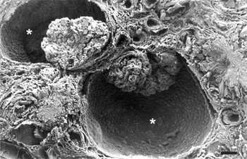 FIG. 4 Scanning electron micrograph (SEM) of freeze-fractured kidney showing two renal corpuscles with dilated urinary space (asterisks) surrounded by tubules and interstitial stroma. Bar = 80 μm.
