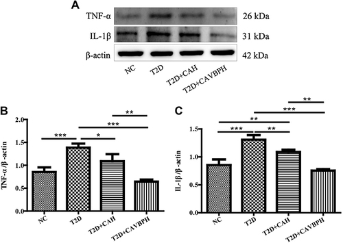 Figure 8 Western blot analysis of inflammatory factors TNF-α and IL-1β proteins. (A) Representative protein bands for TNF-α, IL-1β, and β-actin. (B and C) Quantification analysis of TNF-α/β-actin and IL-1β/β-actin. *p < 0.05, **p < 0.01, and ***p < 0.001.