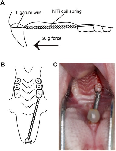 Figure 1 Model of orthodontic treatment.