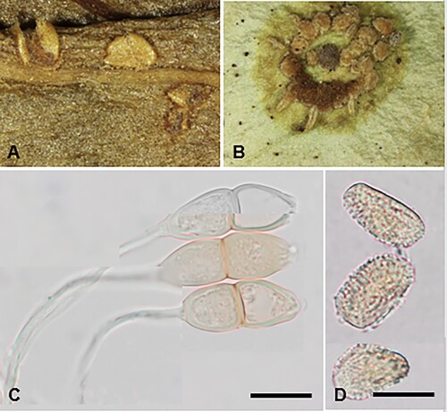 Figure 13. Puccinia kaiku on Parsonsia heterophylla: A, Caeomata. B, Telia. C, Teliospores. D, Aeciospores. Scale bars = 20 μm.