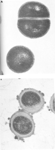 Figure 2 Ultrathin sections of Staphylococcus aureus grown as (A) terrestrial control and (B) in-flight aboard Salyut 7 by Chrétien in 1982 for the Cytos 2 program.Note: Images from Tixador et alCitation77 with permission from Elsevier.