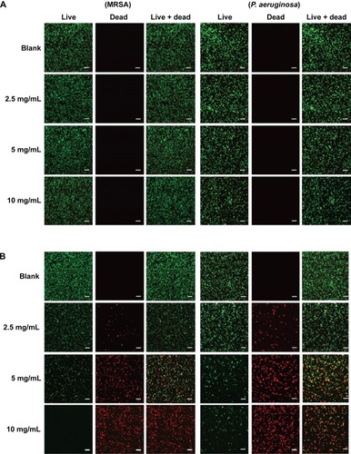 Figure 7 Confocal microscopy images and the percent (%) survival of MRSA (left panel) and Pseudomonas aeruginosa (right panel) after 24 hours of treatment with nanoparticles at different concentrations.Notes: (A) PPNPs, (B) NO/PPNPs, (C) percent (%) survival against MRSA and (D) percent (%) survival against P. aeruginosa. Syto-9 fluorescence (green) indicates intact membrane of healthy bacteria, PI fluorescence (red) indicates membrane destruction and cell death. Bacterial survival at each point is presented as a percentage relative to the control group (buffer alone). Data shown are mean ± standard deviation; n=3. (A and B) Bars represent 20 μm.Abbreviations: PLGA, poly(lactic-co-glycolic acid); PEI, polyethylenimine; PPNPs, PLGA-PEI nanoparticles; NO/PPNPs, NO-releasing PLGA-PEI nanoparticles; MRSA, methicillin-resistant Staphylococcus aureus; PI, propidium iodide; NO, nitric oxide.