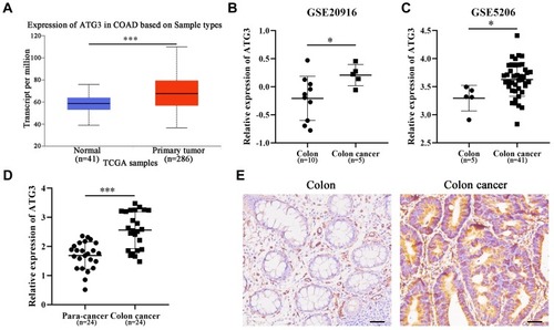 Figure 1 ATG3 is upregulated in colon cancer tissues and cells.Notes: Upregulation of ATG3 in colon cancer is supported by online data from TCGA (A) and GEO database (B and C). Upregulation of ATG3 in colon cancer is confirmed by qPCR (D) and IHC (E) in our collected tissues. COAD: colon adenocarcinoma, “Colon” and “Para-cancer” means normal tissues in this part. *Stands for P < 0.05; ***Stands for P < 0.001.