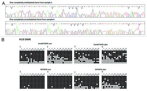 Figure 2. Sequencing analyses of clones from hmMTHFR and MTHFR semen samples. (A) DNA sequencing of H19 in two different clones hmMTHFR-nor (sample 1) and hmMTHFR-abn (sample 4). Arrowheads indicate the methylated CpG islands in sample 1 and unmethylated CpG islands in sample 4. (B) Bisulfite-PCR sequencing for H19 in two representative semen samples endowed with the lowest and the highest prevalence of H19 hypomethylated clones, respectively, from hmMTHFR-nor and hmMTHFR-abn, as well as MTHFR-nor and hmMTHFR-abn semen samples. Filled-in and clear circles represent methylated and unmethylated CpG islands, respectively. The 18 CpG islands within the H19 locus are numbered on the upper side of the circles.