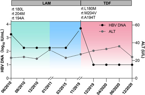 Figure 1 Evolution of HBV DNA (log10 IU/mL), ALT levels (IU/mL), HBV genotypic patterns, and antiviral regimen for the patient.