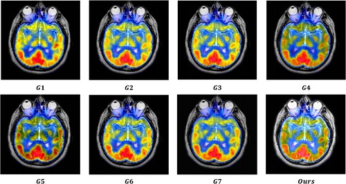 Figure 12. Results obtained from eight image fusion algorithms for MRI-PET image pair #068T in K1.