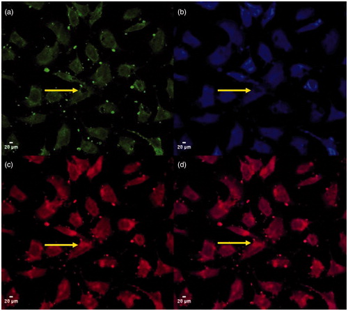 Figure 4. CLSM images of the uptake of CPT@MSN-hyd-PEG-hyd-DOX scale bar 20 µm. (a) corresponds to fluorescein diacetate (FDA) fluorescence, (b) CPT fluorescence, (c) DOX fluorescence and (d) DOX and CPT merged images.