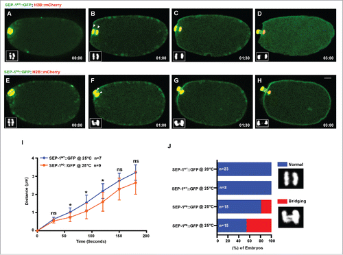 Figure 2. SEP-1PD::GFP causes chromosome segregation defects during meiosis I. Representative images of meiotic chromosome segregation in SEP-1WT::GFP (A-D, green) or homozygous SEP-1PD::GFP expressing embryos (E-H, green) co-expressing H2B::mCherry (red). Lower left insets show H2B::mCherry. (I) Average distance between chromosomes (indicated by arrowheads in B, F) during anaphase in SEP-1WT::GFP or homozygous SEP-1PD::GFP. (J) Percentage of embryos displaying normal chromosome separation (blue), bridging chromosomes (red) during the anaphase I in embryos expressing either SEP-1WT::GFP or homozygous SEP-1PD::GFP (n = number of embryos imaged). Insets show examples scored as normal or bridging chromosomes during anaphase I. Scale Bars, 10 μm. P-values: * = <0.05; ns = not significant (t-test). Error bars indicated standard deviation of the mean.