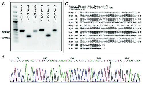 Figure 4. NFKBIA Sequence Trace. (A) Exons 3, 4, and 5 of IκBα were amplified via nested PCR from H460PT and H460CR RNA. PCR products were visualized on a 1% agarose gel, and compared with a 100 bp DNA ladder (Fermentas). (B) Amplicons were sequenced using the AB3130 sequencer. Sequence trace files were obtained for each exon in each cell line, an example of which is shown here. No double peaks were observed in any trace file. (C) Forward and reverse sequences were compared against wild-type sequences for each NFKBIA exon in both cell lines using the basic local alignment search tool for nucleotides (BLASTN). No discrepancies were identified between our sequences and wild-type sequences. A sample sequence of H460 NFKBIA exon 3 is shown here, aligned with wild type IκBα exon 3. H460PT, H460 parent cells; H460CR, H460 cisplatin-resistant cells.