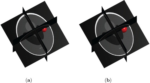 Figure 6. Low and High Grade Glioma in the 3d Shepp–Logan data for T=40. (a) Low Grade Glioma and (b) High Grade Glioma.