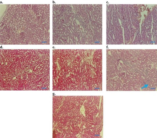Figure 9 Histopathology of kidney (H&E staining, 200×): (A) Control baseline, (B) control injection vehicle, (C) control paste vehicle, (D) i.p. at 10 mg/kg NP, (E) i.p. 50 mg/kg NP, (F) i.p.100 mg/kg NP, and (G) topical dose at 100 mg/kg NP.Note: Arrow in (F) indicates mild inflammatory changes after 100 mg/kg NP dose, given as i.p. injection for 14 days. Bars 50 µm.
