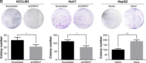 Figure 5 Effect of Zwint on proliferation of HCC cells.