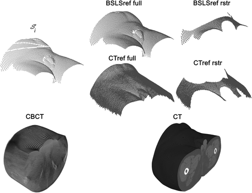 Figure 1. Visualization of the different data sets used. The BSLS set-up scans are stored as point sets Display full size where i indicates fraction. Both the BSLS scanned reference (BSLSref) and the DICOM imported external structure (CTref) are stored as point sets in the BSLS system with slightly higher resolution than the BSLS set-up scan to facilitate a good registration. The BSLS registration was made twice, once to the full reference surface and once to the restricted (rstr for short) reference surface to determine how deformations in potential moving parts affected the registrations. The bony structures in the CBCT volume are automatically extracted by the CBCT software in the registration process. The white lines in Display full size stems from shadows of the treatment head touch guard.