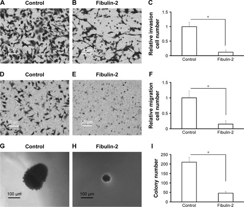 Figure 8 Fibulin-2 overexpression inhibits cell migration (A–C), cell invasion (D–F), and anchorage-independent growth (G–I) in glioma cells.