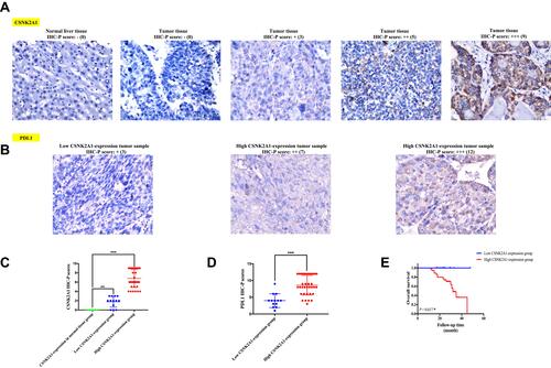 Figure 7 Validation analyses for confirming the immunological and prognostic role of CSNK2A1 in LIHC based on bioinformatic tools. (A) Representative photomicrographs of IHC staining of CSNK2A1 in normal liver tissue and LIHC tissues from high and low CSNK2A1-expression tumor tissue groups. (B) Representative photos of IHC staining of PDL1 in LIHC tissues from high and low CSNK2A1-expression tumor tissue groups. (C) The IHC-P scores of CSNK2A1 in normal liver tissue and LIHC tissues from high and low CSNK2A1-expression tumor tissue groups were compared using Mann–Whitney U-test. (D) The IHC-P scores of PDL1 in LIHC tissues from high and low CSNK2A1-expression tumor tissue groups were compared using Mann–Whitney U-test. (E) Kaplan–Meier curve of OS for clinical LIHC patients with high and low expression of CSNK2A1. ***P<0.001.