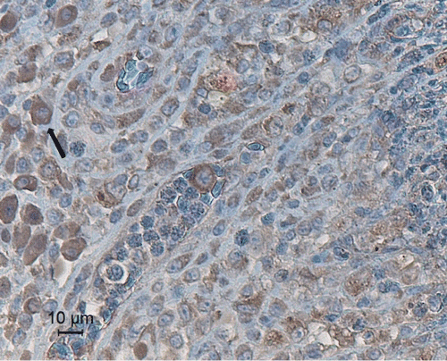 Figure 3.  Fungal granuloma in the air sac of a falcon, stained with peroxidase-labelled concanavalin A (20 µg/ml). Darkly stained macrophages (arrow) are distributed at the edge of the granuloma.