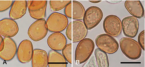 Figure 9. Puccinia confundens on Luzula rufa: A, Urediniospores (PDD 101664, holotype). B, Urediniospores (PDD 99228). Scale bars = 20 μm.