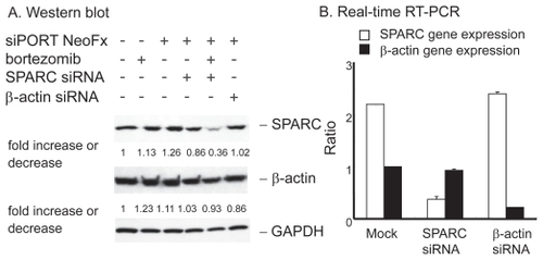 Figure 5 Effect of SPRC siRNA on TaY cells. Twenty four hours after transfection with SPARC or control siRNA, bortezomib is added to the culture. A: Western blot reveals that SPARC siRNA induce modest reduction of SPARC protein levels in TaY cells, while SPARC siRNA does not affect β-actin protein levels. SPARC expression is remarkably reduced when cells were treated with SPARC siRNA followed by bortezomib. B: Reduction of target gene by RNAi: relative gene expression levels are expressed as ratios (copy numbers of target gene/copy numbers of GAPDH).