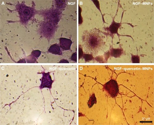 Figure 7 Compartment between different treatment effects on neurite morphology. PC12 cells were treated with NGF (A), NGF + MNPs (B), NGF + quercetin (C), and NGF + quercetin + MNPs (D). For each treatment, 100 cells in each of three separate fields were counted.Abbreviations: MNPs, magnetic nanoparticles; NGF, nerve growth factor.