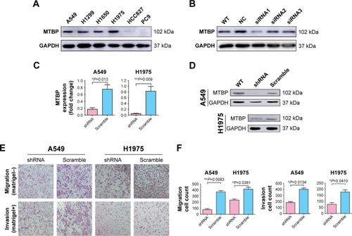 Figure 2 Inhibition of MTBP decreases invasion and migration ability of lung adenocarcinoma cells both in vitro and in vivo.