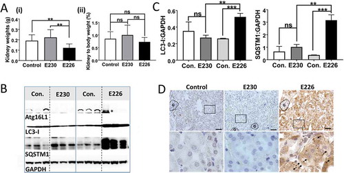 Figure 8. Analysis of kidney. (A) Kidney weights at 2–3 months expressed (i) directly: E230 (atg16l1E230 n = 8, control n = 8, E226 (atg16l1E226) n = 7, control = 8; or as (ii) percentage body weight: E230 (atg16l1E230 n = 9, control n = 8, E226 (atg16l1E226) n = 7, control = 6. (B) Western blot of kidney lysates from 3 representative mice. Membranes strips taken from the appropriate molecular weight range were analyzed separately using the indicted antibodies. (C) Bar graphs show levels of LC3 and SQSTM1 relative to GAPDH. (D) Histochemical sections of kidneys immunostained for SQSTM1. (G) Indicates glomerulus. Enlarged regions of interest are shown in lower panels. Arrows: SQSTM1 inclusions. Data from control mice were pooled. Statistical analysis was done by unpaired t test. Error bars represent ±SEM. ***-P < 0.001, **-P < 0.01; ns, non-significant. Magnification 20X, scale bars: 50 µm.