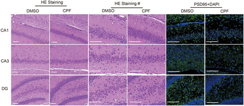 Figure 1. CPF affects the structural changes of synapses in rat hippocampal neurons. Representative images of HE staining (different magnifications), PSD-95 (green) and DAPI (blue) immunofluorescence staining in CA1, CA3 and DG regions of the rat hippocampus in the two groups (scar bar: 100 μm).