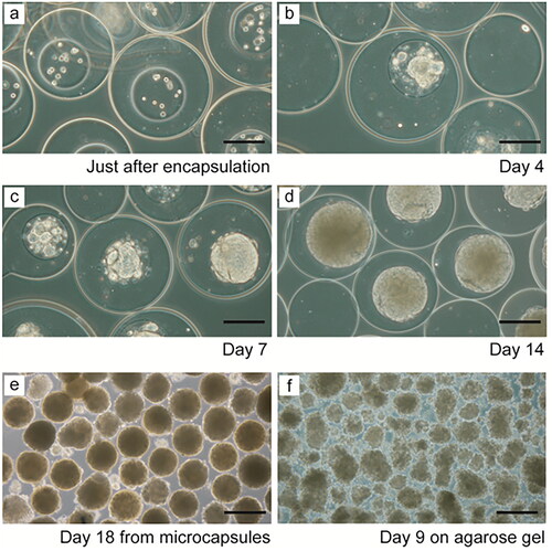 Figure 5. Core-shell gelatin-alginate microparticles for cervical cancer cell encapsulation produced using a hybrid extrusion and microfluidic approach. (a–d) HeLa cell growth and spheroid formation after encapsulation in two-layered microcapsules. (e) Spheroids harvested from microcapsules after 18 days of cultivation. (f) Spheroids formed on agarose gel after 9 days of cultivation. Scale bar in (a–d) = 150 μm; scale bar in (f) = 300 μm. Figure taken from [Citation63] reproduced with permission from John Wiley and Sons.