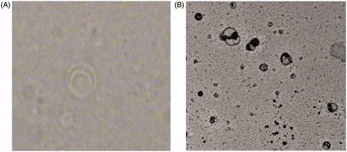 Figure 1. (A) Photomicrographs (40×) of ESS liposomes; (B) transmission-electron micrograph (TEM) of ESS liposomes.