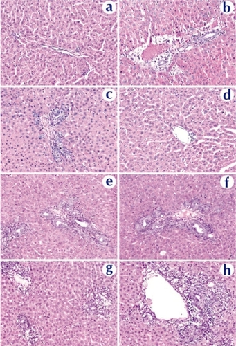 Figure 9 Histopathological examination of liver tissue extracted on day 3 from rats received naked DNA (c and d), chitosan-DNA nanoparticles (e and f), or PEI-DNA nanoparticles (g and h), in comparison with the naïve rat (a and b). Liver samples were collected on day 14, cryosectioned (8 μm thickness), and stained with H&E.Abbreviation: PEI, polyethylenimine.