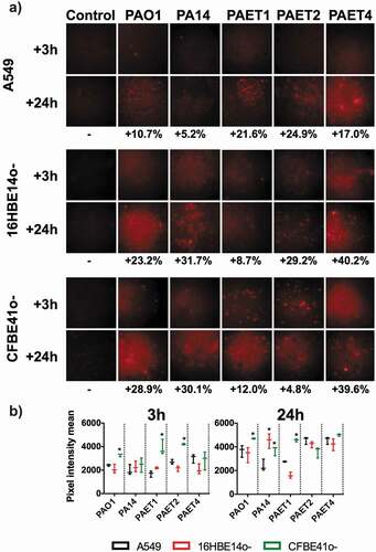 Figure 4. Oxygen consumption of A549, 16HBE14o- and CFBE41o- P. aeruginosa-infected monolayers. A) Fluorescence microscope images showing the red fluorescence emission of the hypoxia probe dye after 3 and 24 h of initial infection of the PAO1, PA14, PAET1, PAET2 and PAET4 strains. Uninfected A549, 16HBE14o- and CFBE41o- were also included as controls. The red-intensity signal relates to cellular hypoxia. The percentage of red intensity increases from 3 h to 24 h of intracellular persistence per infection and lung epithelial cell type and is included in the figure. The percentages were calculated with ImageJ software using the pixel intensity averages from ten different images of each infectious condition and time-point. B) Graphs showing the pixel intensity averages and the respective standard error of the mean of each P. aeruginosa intracellular infection of A549, 16HBE14o- and CFBE41o- cells incubated for 3 and 24 h. Significance differences among lung cell infections with the same P. aeruginosa strains are denoted with asterisks (*) p > 0.05.