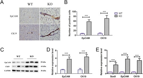 Figure 4. Ductular reaction analysis in G6pc−/− mice. (A) Immunohistochemical results revealed that EpCAM-and CK19-positive cells (brown) were significantly increased in G6pc−/− mice compared to WT mice. (B) Quantification of positive cell number in A. (C) WB analysis of expression level of ductular reaction markers (EpCAM and CK19) in G6pc−/− mice compared to WT mice. (D) Quantification of proteins in C. (E) qRT-PCR analysis of expression levels of ductular reaction markers (Sox9, EpCAM, and CK19) in G6pc−/− mice compared to WT mice. Scale bar = 200 μm. N = 8. ***P < 0.001 compared to WT mice.