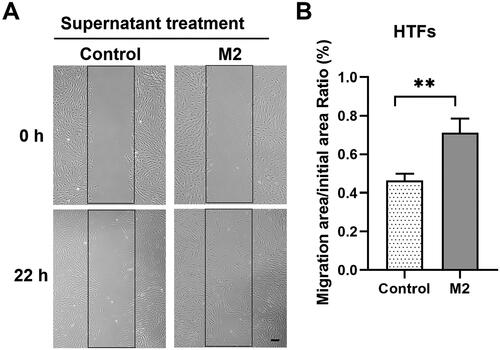 Figure 5. M2 supernatant promoted the migration of primary HTFs in wound healing assay. HTFs were cultured with M2-conditioned medium (M2 group) or fresh culture medium (control group). (A) Light microscopic images of the scratch wound area taken at 0 and 22 h in the presence or absence of M2 supernatant. Scale bar: 100 μm. (B) Quantitative analysis of the ratio of the cellular migration area to the initial scratch area; the initial scratch area in each group was set as 100%. All experiments were repeated three times independently. **P < 0.01.