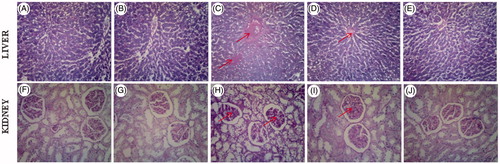 Figure 5. (A–J) Histopathology of rat liver and kidney sections stained with PAS. (A,F) normal control rats (100 X), (B,G) normal rats treated with tyrosol (100 X), (C,H) diabetic control rats(100 X), (D,I) diabetic rats treated with tyrosol (100 X), (E,J) diabetic rats treated with glibenclamide (100 X).