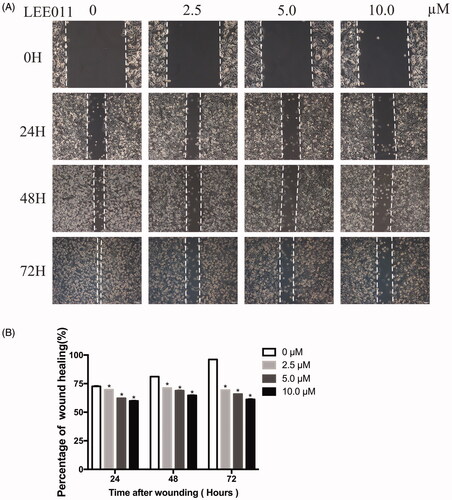 Figure 4. LEE011 reduces cell migration of MDA-MB-231 in vitro. Cell migration was determined by wound healing assays after an escalating dose (of LEE011 treatment imposed on MDA-MB-231 cells for the indicated time. (A) Representative images of MDA-MB-231 cell migration after 0, 2.5, 5.0, 10.0 µM LEE011 exposure for 24, 48, 72 hours. The magnification is 200× (scale bar, 100 µm). (B) Cell migration of MDA-MB-231 was measured after LEE011 exposure. Two-tailed Student’s t-test was utilized to determine statistical significance. Error bars indicate standard deviations. p < .05 was considered significant (*p < .05).