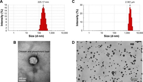 Figure 1 Characterizations of CLPs and microbubbles.Notes: (A) The size distribution of CLPs. (B) Transmission electron microscopic image of CLP (×100,000). (C) The size distribution of microbubbles. (D) Optical microscopic image of microbubbles (×400).Abbreviation: CLP, chitosan-modified polymyxin B liposome.