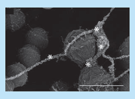 Figure 7.  Extracellular DNA in Enterococcus faecalis biofilm. Visualization of labeled strands by using an anti-dsDNA monoclonal antibody conjugated to an immunogold particle (asterisks; scale bar = 250 nm).Reproduced from [Citation59].