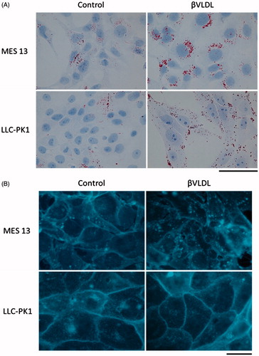Figure 4. Localization of neutral lipid and FC in MES 13 and LLC-PK1 cells loaded with βVLDL. (A) The intracellular distribution of neutral lipid was examined using Oil Red O staining. (B) The intracellular distribution of FC was examined using filipin staining. Cells were incubated for two days with or without 0.2 mg TC/mL βVLDL. Bar; 20 μm.