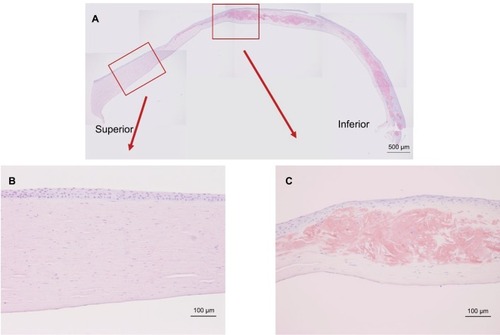 Figure 2 Congo red staining of the excised cornea.