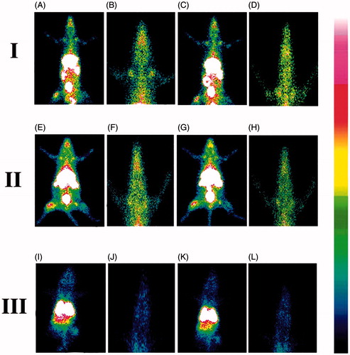 Figure 4. Gamma scintigraphy images of rats after receiving radiolabeled MGF/radiolabeled SYF/radiolabeled AZT. (I) rats received 99mTc labeled MGF at 1 h (A, B) and at 5 h (C, D) post i.v. injection; (II) rats received 99mTc labeled SYF at 1 h (E, F) and at 5 h (G, H) post i.v. injection; (III) rats received 99mTc labeled free drug at 1 h (I, J) and at 5 h (K, L) post i.v. injection. A, C, E, G, I, and K are whole animal image; B, D, F, H, J, and L are magnified brain part.