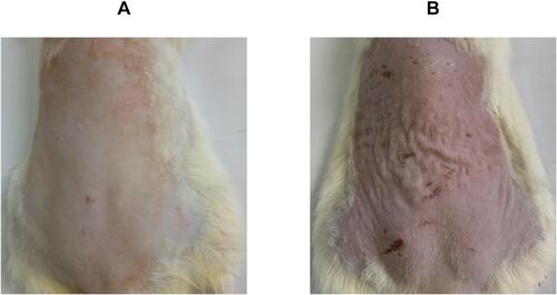 Figure 1 Rats’ dorsal skin photographs of (A) normal control group (unexposed to UVB-irradiation) and (B) positive control group (exposed to UVB-irradiation, where skin alterations were visible, as the skin was erythematous and wrinkled, as well as, being hyperpigmented in certain areas).