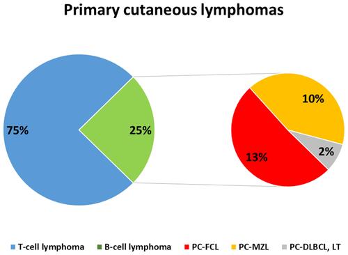 Figure 1 Frequency distribution of primary cutaneous lymphomas.