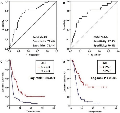 Figure 2 Outcomes of receiver operating characteristic (ROC) curve analyses and survival outcomes per advanced lung cancer inflammation index (ALI): (A) ROC curve analysis for progression- free survival, (B) ROC curve analysis for overall survival, (C) Progression-free survival, and (D) Overall survival.