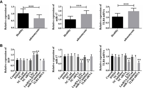 Figure 1 Expression of lncRNA H19, miR-17, and TLR4 mRNA in adenomyosis and effects of LNG on them. (A) LncRNA H19 is down-regulated and miR-17 and TLR4 mRNA are up-regulated in adenomyosis, ***P<0.001 vs control group. (B) LNG up-regulates lncRNA H19 and down-regulates miR-17 and TLR4 mRNA, **P<0.01 vs control group.