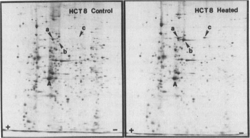 Figure 7. Autoradiogram of a two-dimensional gel showing the enhanced synthesis of hsp70 in heat shocked human tumour HCT-8 cells in vitro. Monolayers of HCT-8 cells were heated at 45°C for 15 min, labelled at 37°C for 4 h, and cellular proteins analysed. First dimension (IEF) was from left to right, and the second dimension was from top to bottom. Three members of hsp70 family were identified: (a) hsp70-a; (b) hsp70-b; and (c) hsp70-c. The protein synthesis profile of non-heated control was shown in the left panel. The heat shock enhanced the expression of hsp70-b and induced that of hsp70-c.