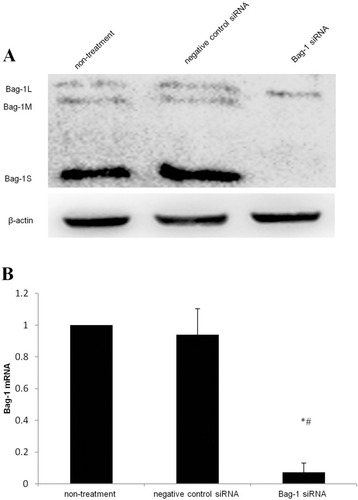 Figure 2 Silencing of Bag-1 expression using Bag-1 siRNA.A549 cells were grown and infected by Bag-1 or negative control siRNA for 48 hrs. (A) Western blot results. (B) This graph is data of the Bag-1 mRNA levels. *p<0.001 vs the non-treatment group and #p <0 0.001 vs the negative control siRNA group.