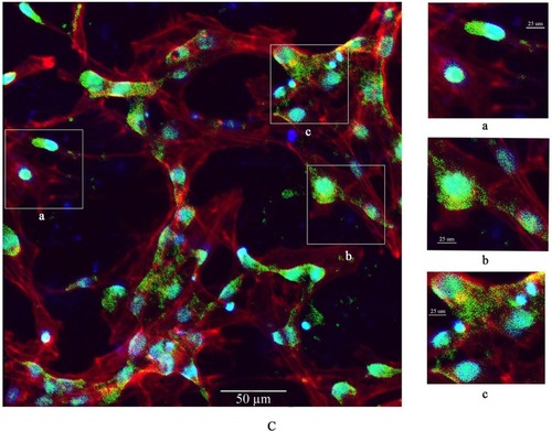 Figure 7 Confocal microscopy images of primary cultured rat LCs: cell nuclei (blue); F-actin cytoskeleton network (red); and FITC–nano-TiO2 (green).Notes: (A) LCs were treated with 0, 10, and 40 µg/mL FITC–nano-TiO2 for 24 hours. (B) After treatment of LCs with 10 µg/mL FITC–nano-TiO2 for 24 hours, nanoparticles were distributed in the F-actin cytoskeleton network. (C) After treatment with 40 µg/mL FITC–nano-TiO2 for 24 hours, nanoparticles were distributed in both the F-actin cytoskeleton network and nuclei of LCs, indicating entry into both cytoplasm and nuclei.Abbreviations: LCs, Leydig cells; FITC, fluorescein isothiocyanate; nano-TiO2, nanoparticulate TiO2.