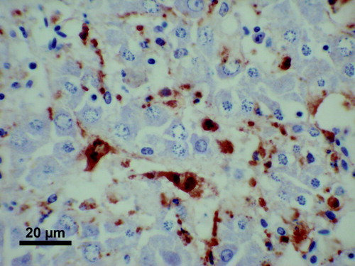 Figure 7.  Immunohistochemistry using 1H4 mAb to BLS-associated antigen, on the liver from an affected bird. Antigen is present in sinusoidal cells of liver parenchyma.